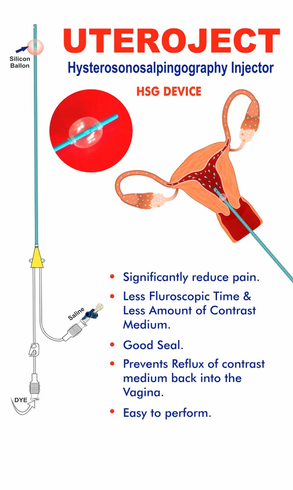 Ống thông bóng HSG